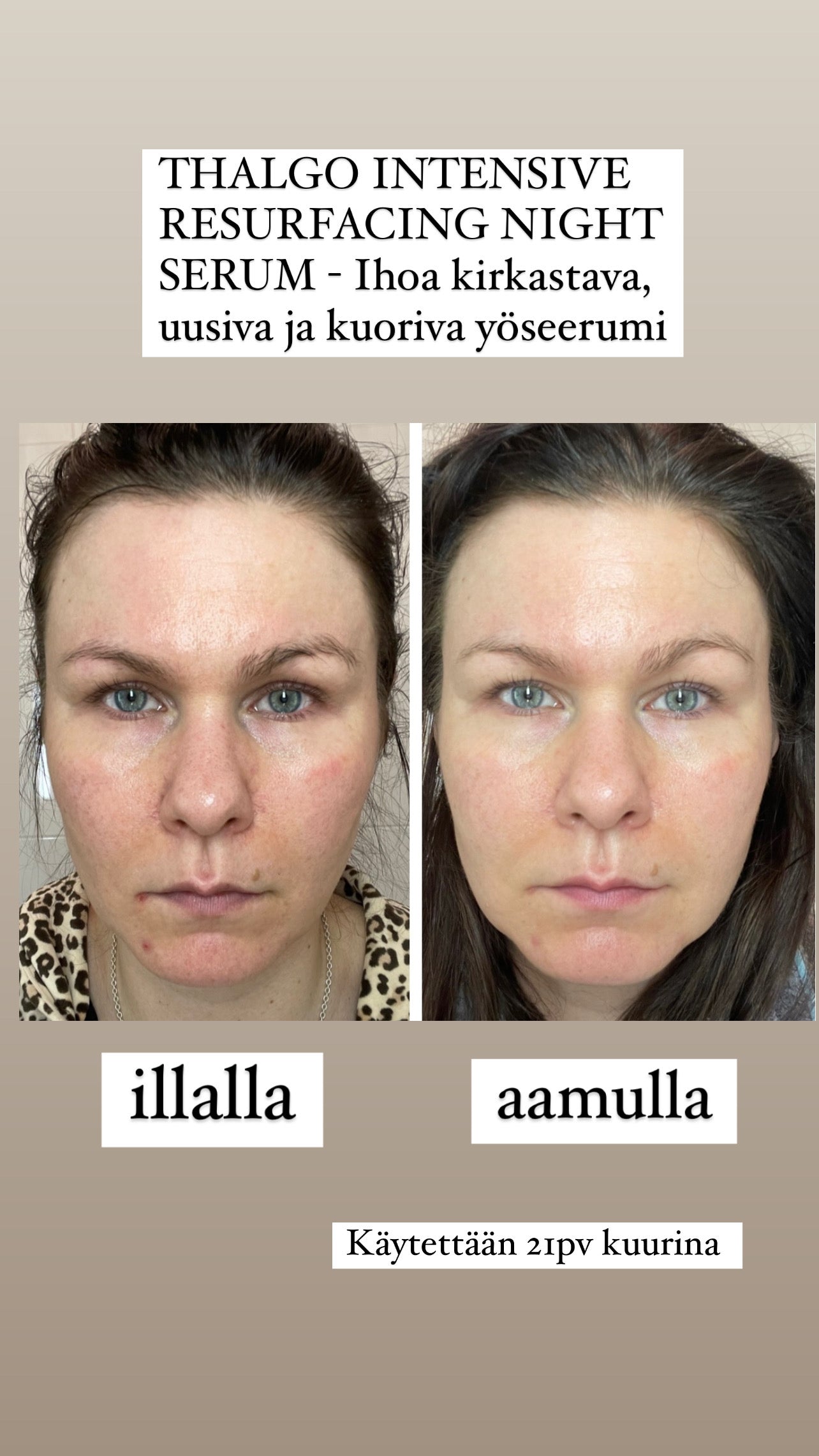 THALGO INTENSIVE RESURFACING NIGHT SERUM - Ihoa kirkastava, uusiva ja  kuoriva yöseerumi. Myös akne iholle!