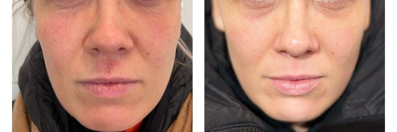 THALGO NUTRI-COMFORT PRO MASK - Karhealle, kuivalle iholle