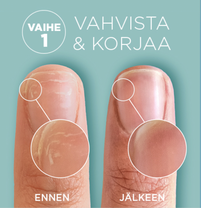CND RESCUERXx™ - Korjaa vaurioituneet kynnet palkitulla RescueRXx™-keratiinikuurilla