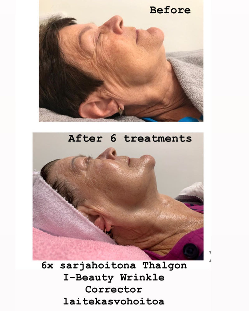 THALGO I-BEAUTY 6KRT SARJAHOITO - Anti-age kasvohoito