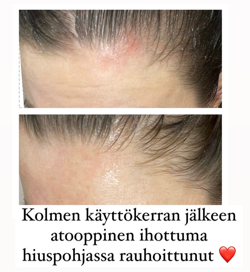 THALGO PLASMALG GEL - Levägeeli ihon moniin ongelmiin kasvoille ja vartalolle. Sopii myös hiuspohjaan!